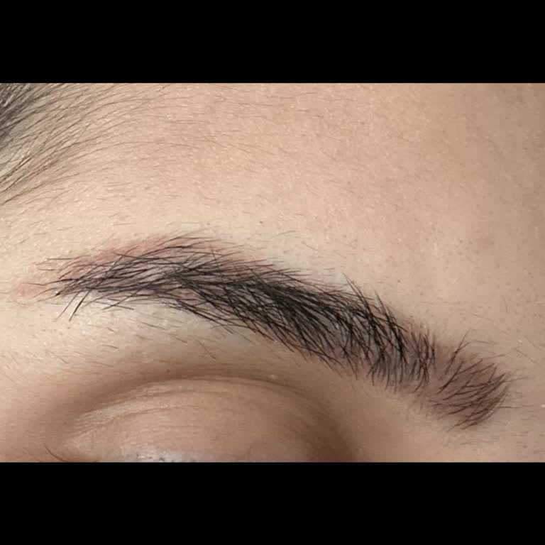 Microblading İşleminde Renk Değişimi Ve Kalıcı Sorunlar