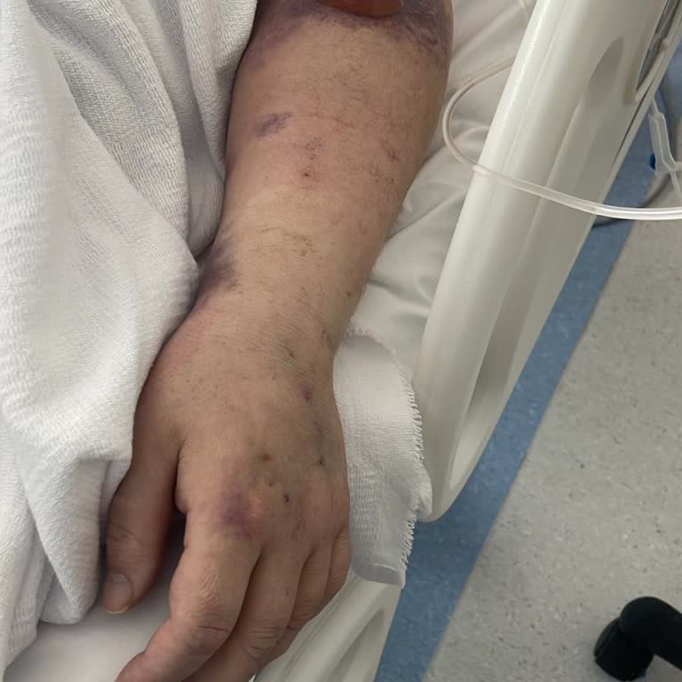 Yanlış Tedavi Sonucu Babamı Kaybettik