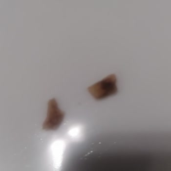 Torku Gofret İçinden Çıkan Sert Cisim Şoku