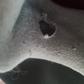 Adidas Ayakkabının 2 Ayda Kullanılamaz Hâle Gelmesi