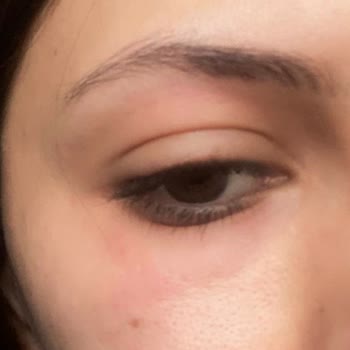 Övgülerle Satılan Ürün Hayal Kırıklığı Yarattı: Sağlık Sorunlarına Dikkat!