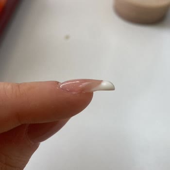 Hijyen Sorunu Ve Müşteri Hizmeti Eksikliği