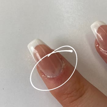 Hijyen Sorunu Ve Müşteri Hizmeti Eksikliği