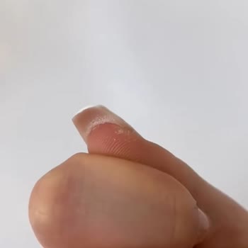 Hijyen Sorunu Ve Müşteri Hizmeti Eksikliği