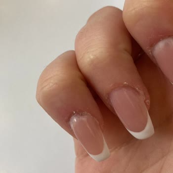 Hijyen Sorunu Ve Müşteri Hizmeti Eksikliği