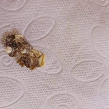 Eti Lifalif Yulaf Ezmesinde Şok Edici Yabancı Madde