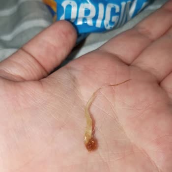 Ruffles Cipsinde Şok Edici Deneyim: Sağlık Sorunları Ve İlgisizlik