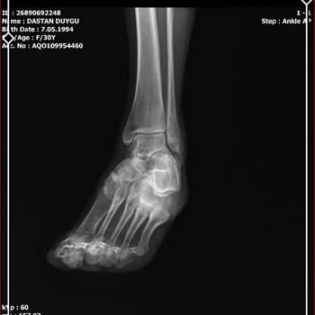 Gimsa Market Önündeki Tehlikeli Kaldırım Sorunu