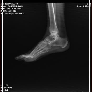 Gimsa Market Önündeki Tehlikeli Kaldırım Sorunu