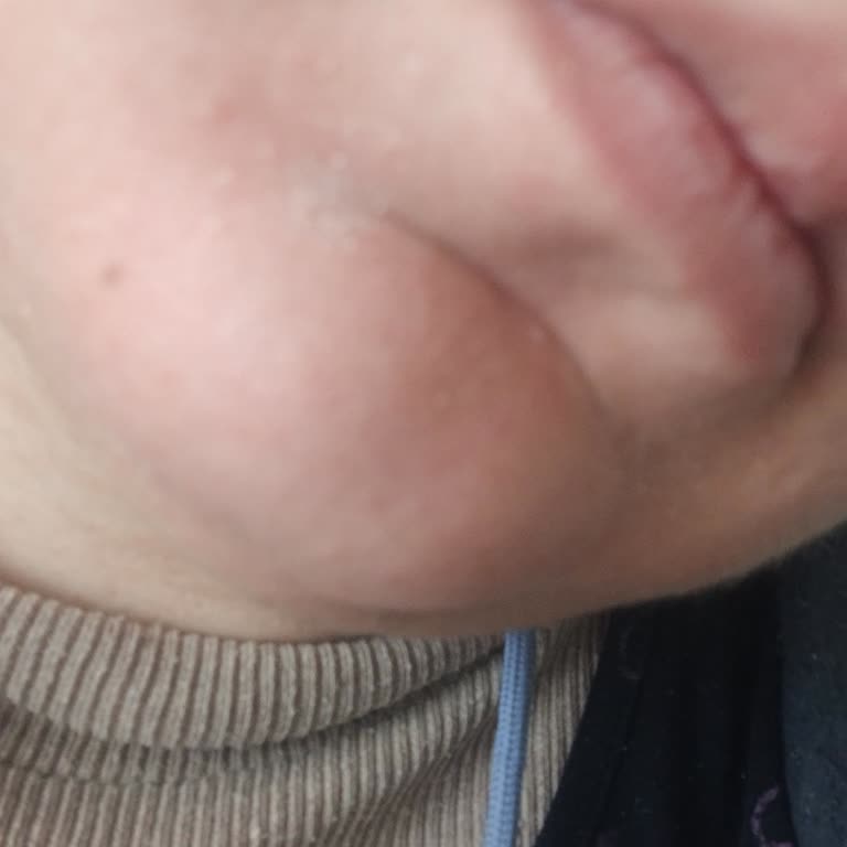 Harrem Concept Gül Mayası Ürünü Cildimi Kuruttu!