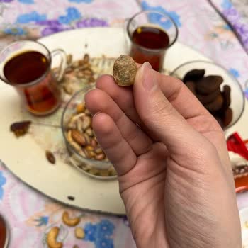 Kuruyemiş İçinden Çıkan Taş Diş Sağlığını Tehdit Ediyor