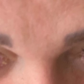 Hijyen Sorunu Ve İletişim Eksikliği