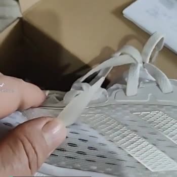 Adidas Spor Ayakkabımın Logo Kopma Şikayeti Ve Müşteri Hatası Demeleri