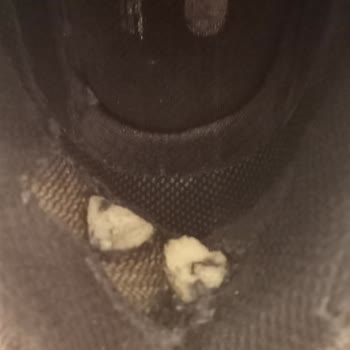 Skechers Ayakkabı Garanti Süresi İçinde Yırtıldı