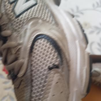 6 Ayda Açılan Ayakkabıya Kullanıcı Hatası İddiası!