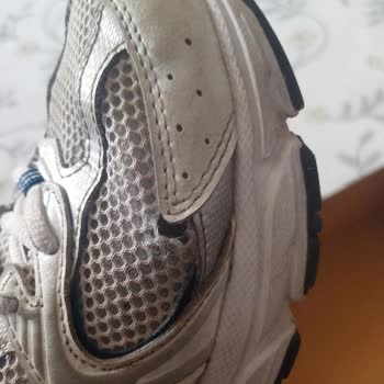 6 Ayda Açılan Ayakkabıya Kullanıcı Hatası İddiası!