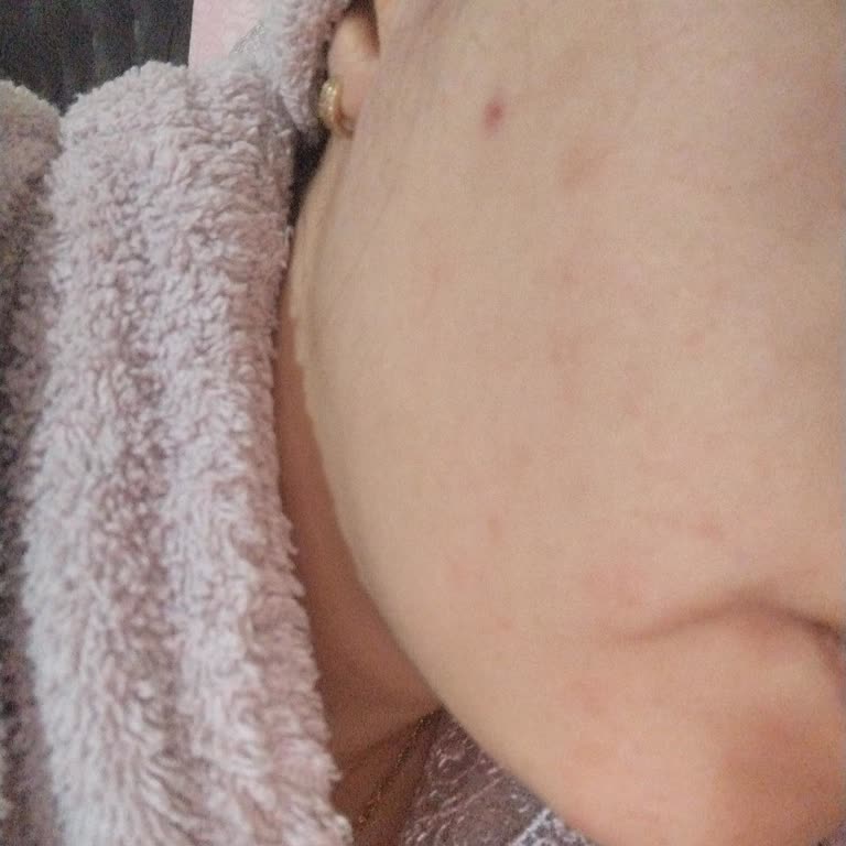 Cilt Bakım Ürünleri Yüzümü Mahvetti!