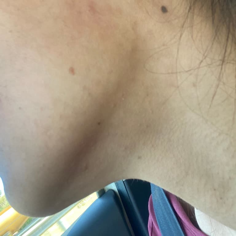 Cilt Bakımı Sonrası Yaşanan Sorunlar Ve İade Talebi