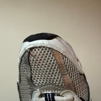 New Balance Ayakkabıda Yırtılma ve Garanti Sorunu