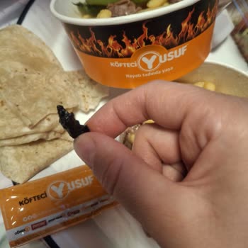 Çiğ Döner Ve Yabancı Cisim Şoku