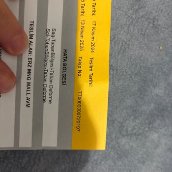 Greyder Ayakkabılarında Çıkmayan Lekeler Ve Yetersiz Müşteri Hizmeti