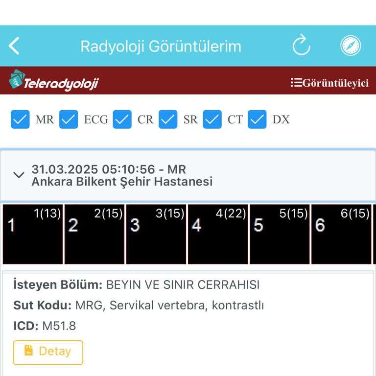 Bilkent Şehir Hastanesi'nde MR Sonuçları Gecikiyor: Sağlıkta Ciddi Aksaklık
