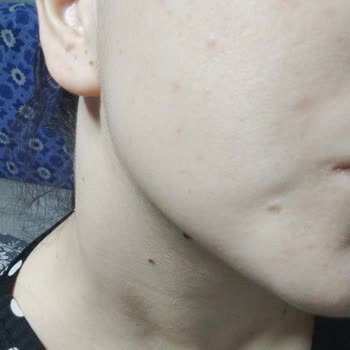 Cilt Ürünleri Cildimde Sorun Yarattı