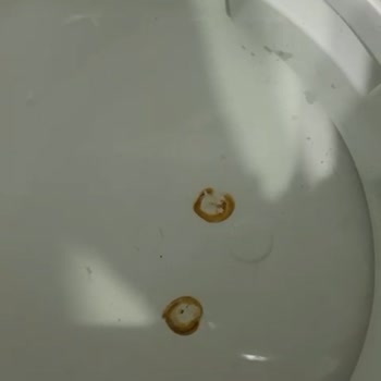 Arıtma Cihazı Su Kaçırıyor Ve Destek Alamıyorum