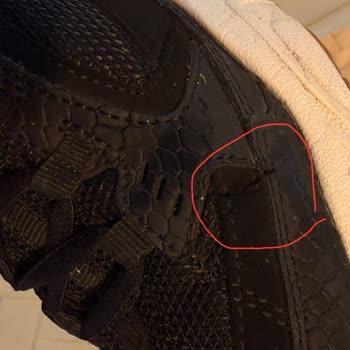 Skechers Garanti Sözüne Rağmen Ayakkabı Sorunu Çözülmedi