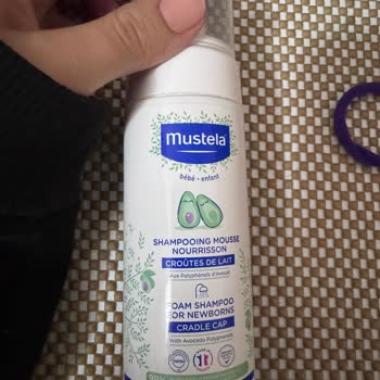 Konak Şampuanı Alerji Problemi