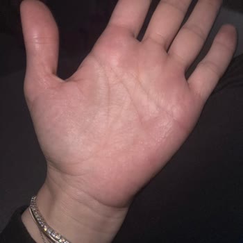 Konak Şampuanı Alerji Problemi