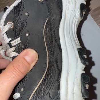 Skechers Ayakkabı Yırtılması Ve Yanlış Bilgilendirme
