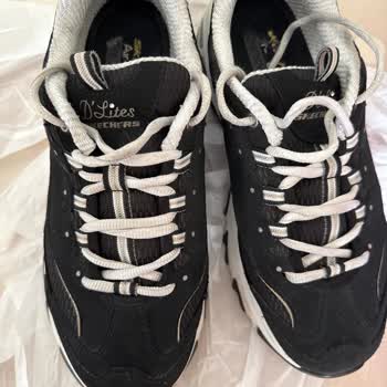 Skechers Ayakkabı Yırtılması Ve Yanlış Bilgilendirme