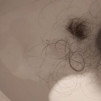 Saç Dökülmesini Artıran Bakım Seti Mağduriyeti