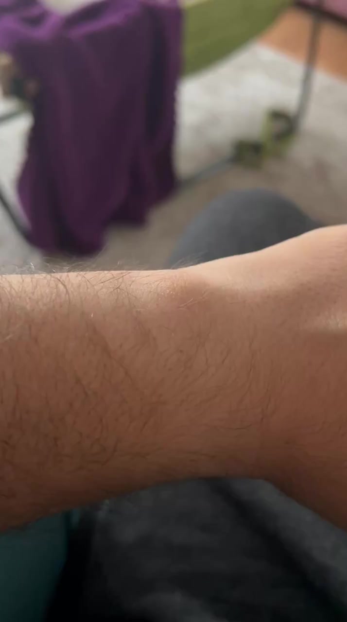 My Huawei Watch 4 Burned My Wrist at the Sensor Area — I Can’t Use It Anymore video cover