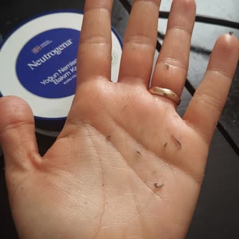 Neutrogena Krem Cildimde Soyulma Sorunu Yaratıyor