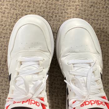 Adidas Ayakkabılarda Sararma Sorunu