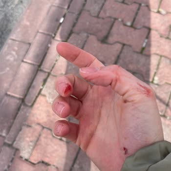 Fren Arızası Nedeniyle Yaşanan Tehlikeli Anlar