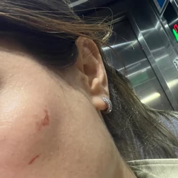 Fren Arızası Nedeniyle Yaşanan Tehlikeli Anlar