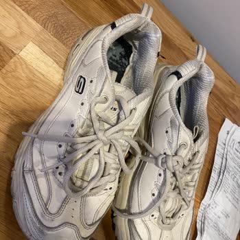 Skechers Ayakkabının Hızla Deformasyonu Ve Değişim Talebi