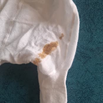 Sürekli Sızdıran Bebek Bezi Hayal Kırıklığı