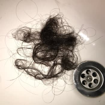 Saçlarımın Kâbusu: Dökülme Ve Kepek Sorunu