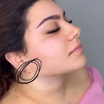 Bellapais Güzellik Merkezi Yanıltıcı Prenses Gıdı İşlemi Ve Sonuçsuz Deneyim