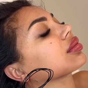 Bellapais Güzellik Merkezi Yanıltıcı Prenses Gıdı İşlemi Ve Sonuçsuz Deneyim