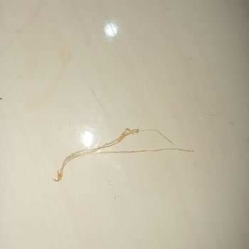 Ruffles Ketçap Aromalı Cips Ürününde Hijyen Endişesi: Yabancı Madde Tespiti