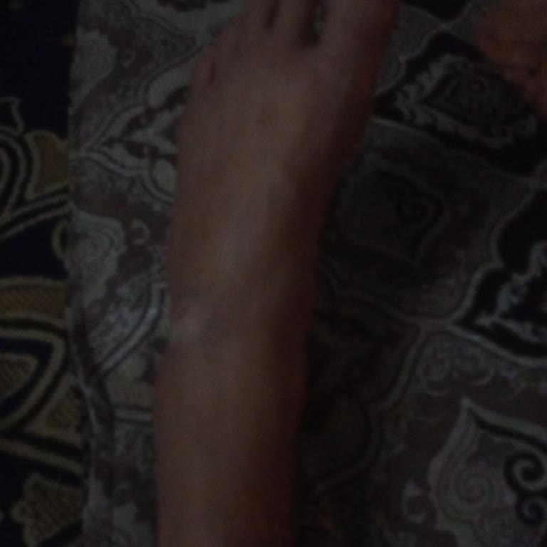 Hastanede MR Bekleme Çilesi