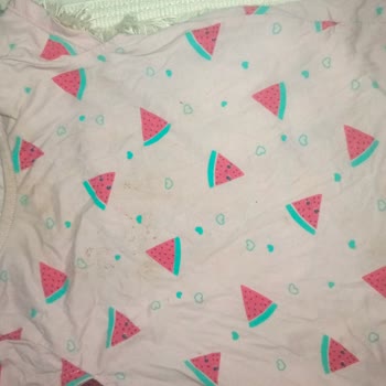 Vestel Çamaşır Makinesi Temizlik Sorunu Ve Yetersiz Servis Desteği