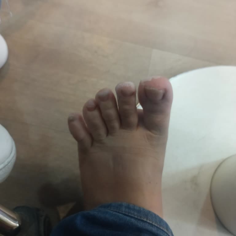 LCW İle Ayakkabı İade Sorunu