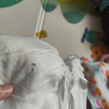 Bebek Bezi İçindeki Tehlikeli Yabancı Cisim