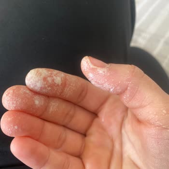 Vatan Deterjan; Leke Sihirbazı Hayal Kırıklığı